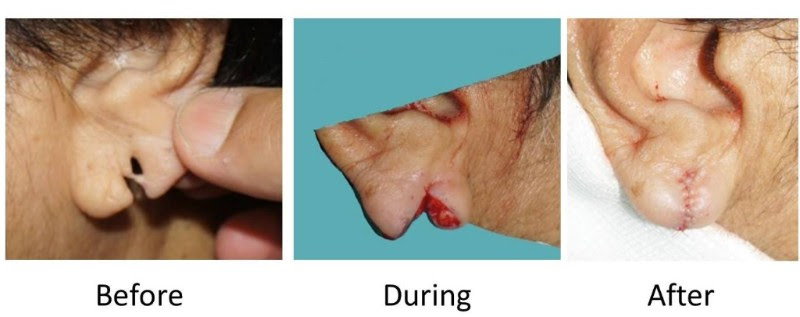 split ear repair